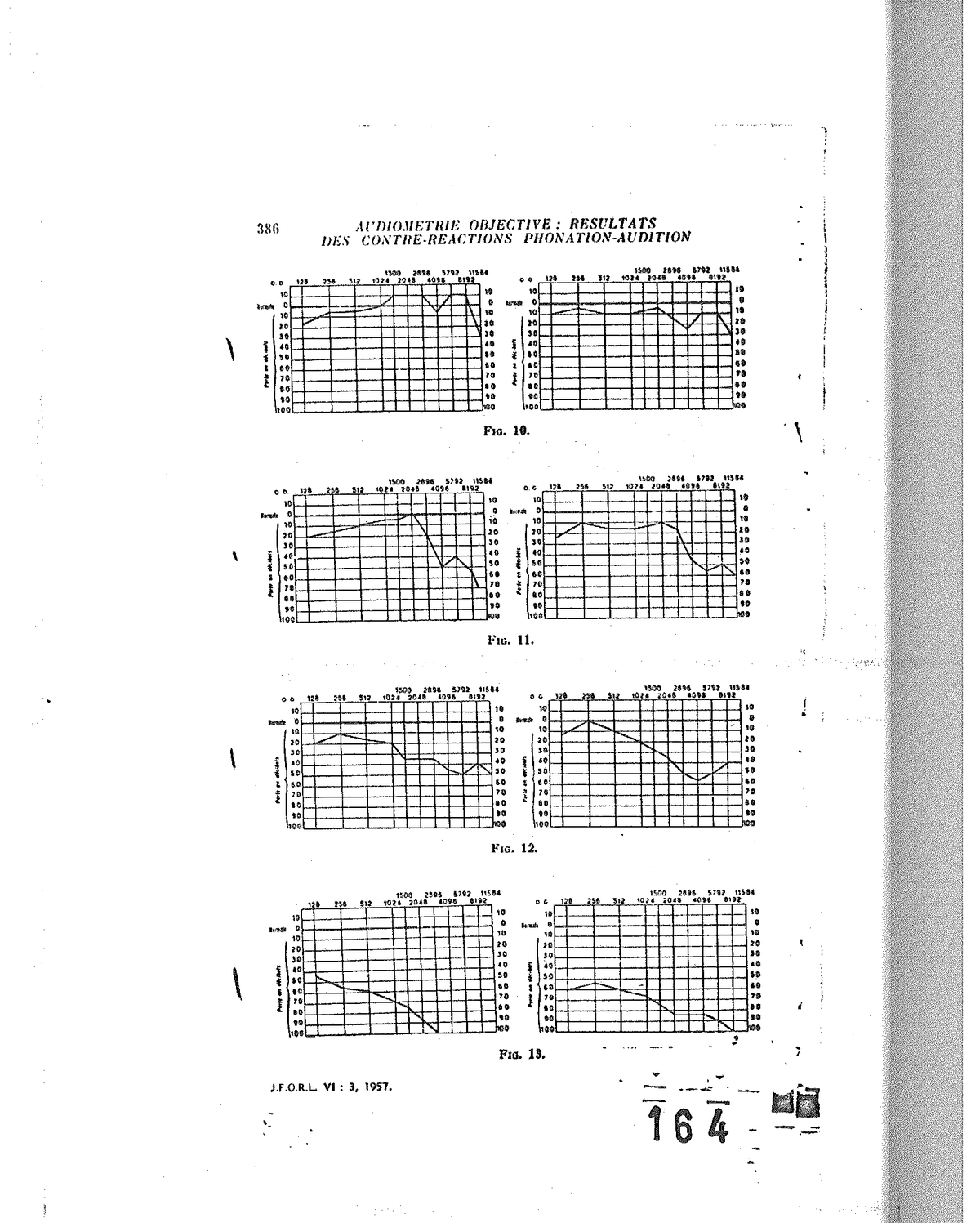 Fig. 10 à Fig. 13 — Quatre stades de la surdité professionnelle, comparant chant