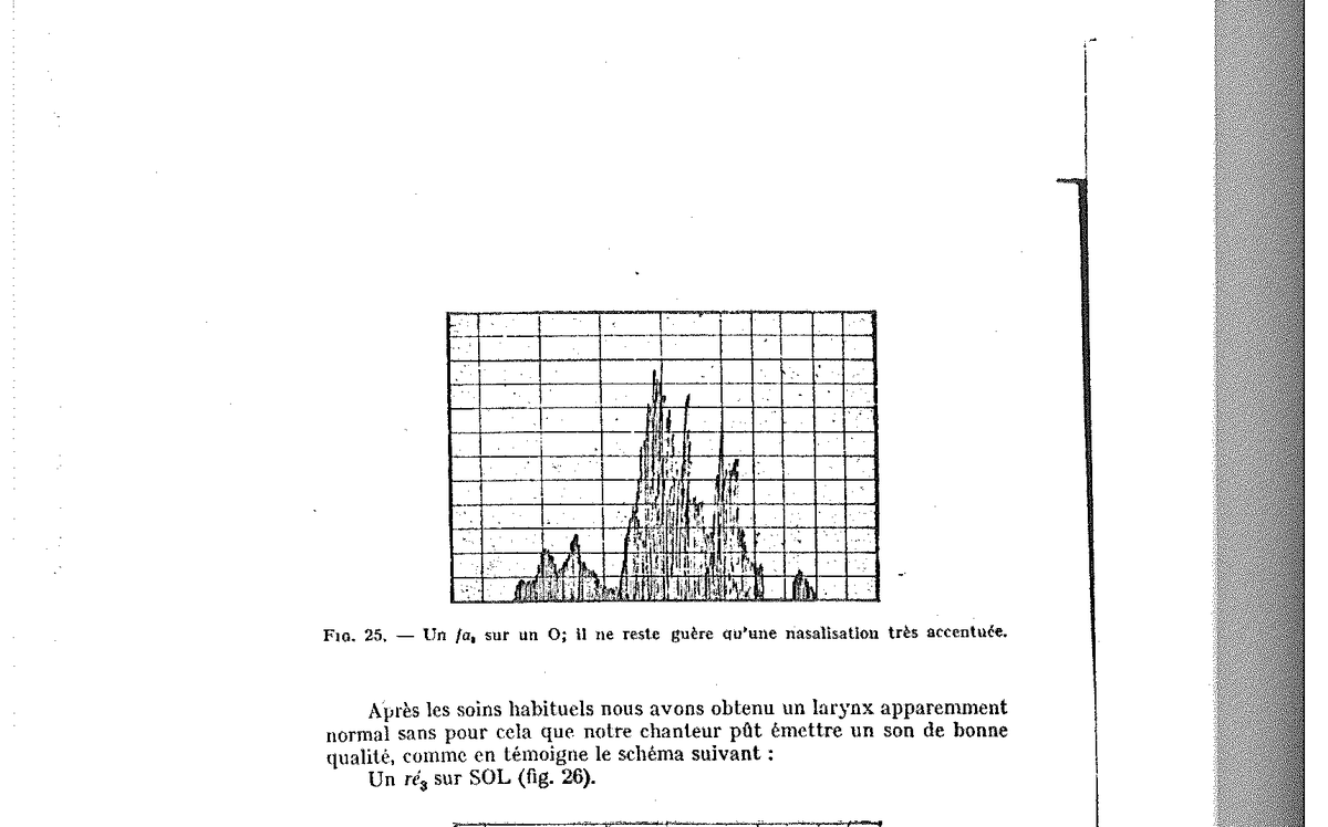 Figure 25